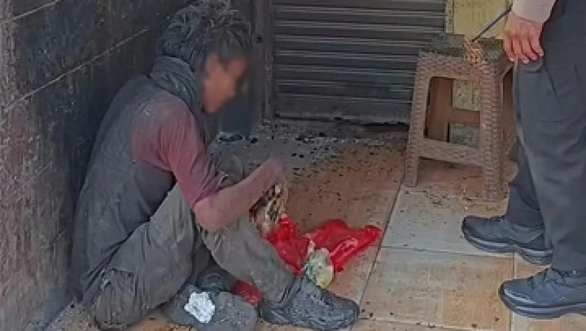 thumb